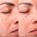 Creme Facial Despigmentante - Tratamento de Manchas Escuras Lotus Radiance 50ml - Freshly Cosmetics - 3