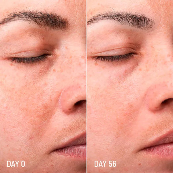 Creme Facial Despigmentante - Tratamento de Manchas Escuras Lotus Radiance 50ml - Freshly Cosmetics - 3