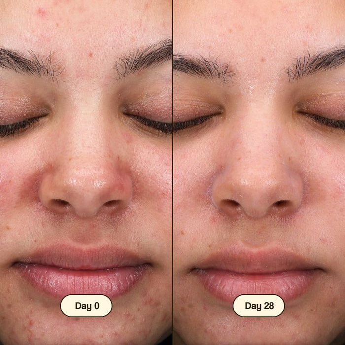 Limpeza Facial com Ácido Salicílico 100ml - Freshly Cosmetics - 2