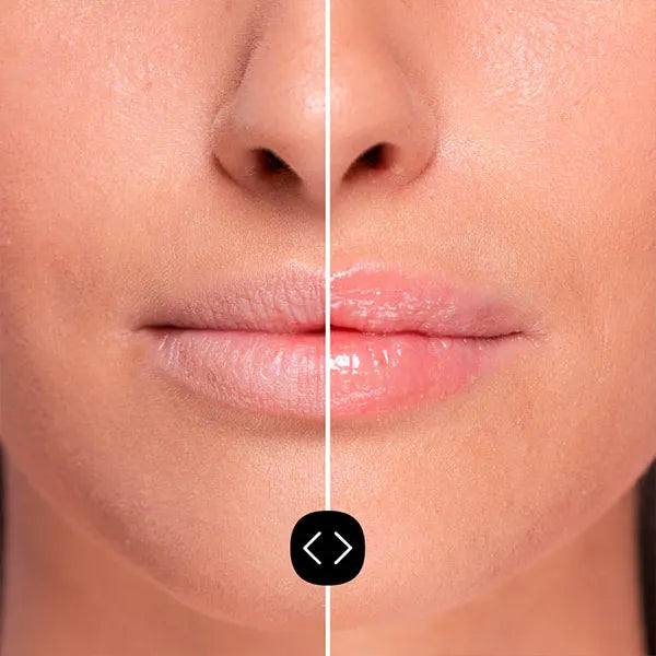 Volumizador de lábios Hyaluronic Lip Volumiser - Freshly Cosmetics - 2