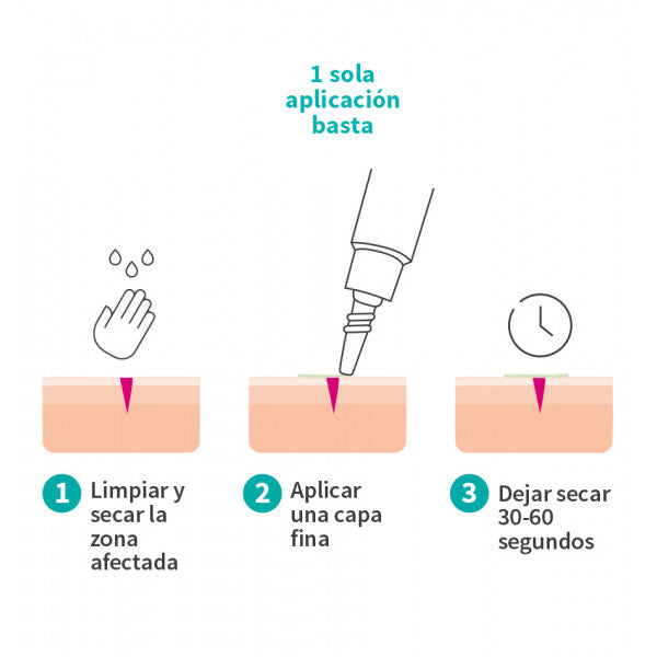 Curativo Líquido Mimetik 1,5 G - Beter - 3